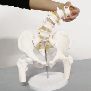 MODELO DINÁMICO DE FÉMUR LUMBAR PÉLVICO
