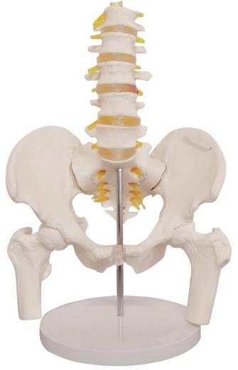MODELO DINÁMICO DE FÉMUR LUMBAR PÉLVICO